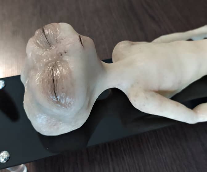 Grey Alien Autopsy Figure