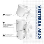 Lumbar Vertebra Coffee Mug